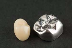 modern dental crowns