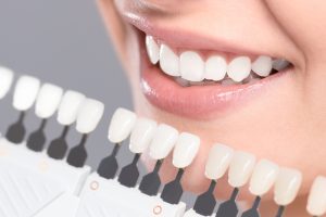 allen teeth whitening