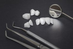 allen dental bridges