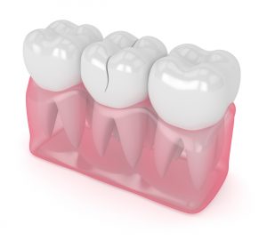 allen dental emergency care