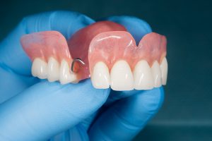 allen partial dentures