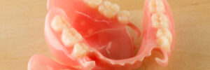 Allen partial denture