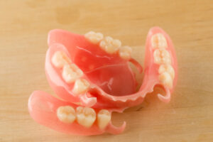 Allen partial denture