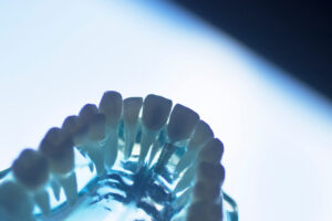 allen dental implants